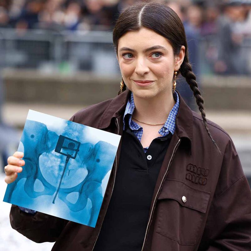 Lorde Announces Ultrasound World Tour 2025 Dates, Tickets & What to Expect